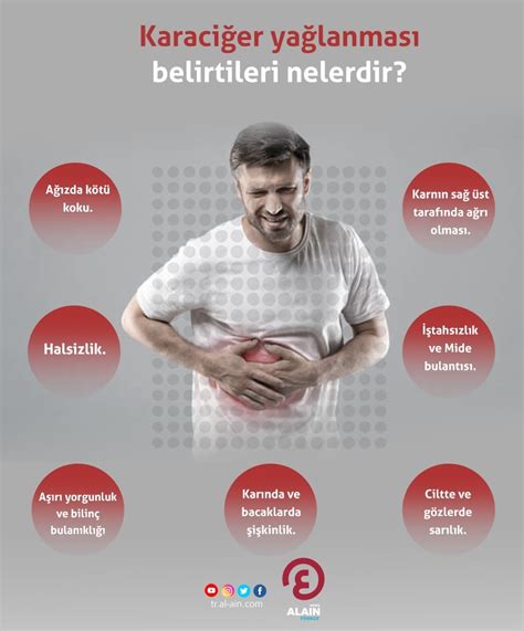 Karaciğer Yağlanması Belirtileri Nelerdir?