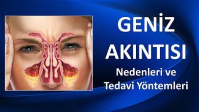 Geniz Akıntısı Neden Olur? Nasıl Geçer?