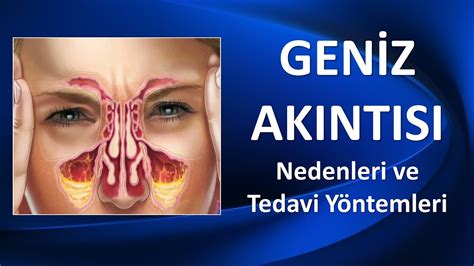 Geniz Akıntısı Neden Olur? Nasıl Geçer?